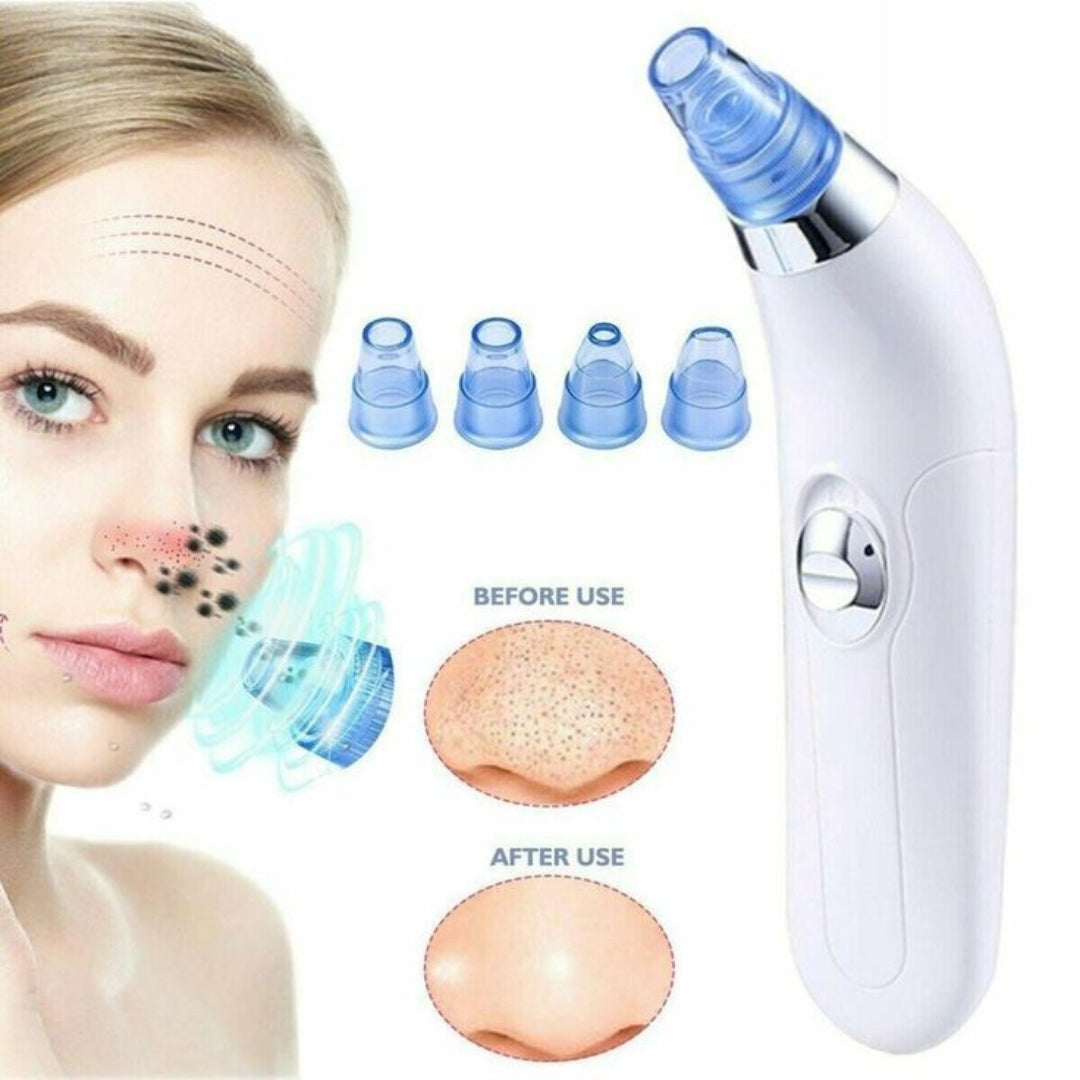 "Advanced 4-in-1 Blackhead Removal Machine: Professional Acne Pore Cleaner Vacuum Suction Tool with Clinical Precision and Effective Results"